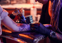 5 Things You Didn’t Know About Laser Tattoo Removal Tattoo