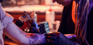 5 Things You Didn’t Know About Laser Tattoo Removal Tattoo
