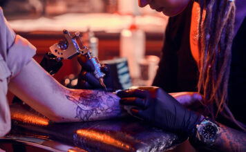 5 Things You Didn’t Know About Laser Tattoo Removal Tattoo