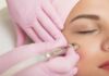 Transform Your Skin: The Ultimate Guide To Microneedling Skin Microneedling
