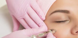 Transform Your Skin: The Ultimate Guide To Microneedling Skin Microneedling